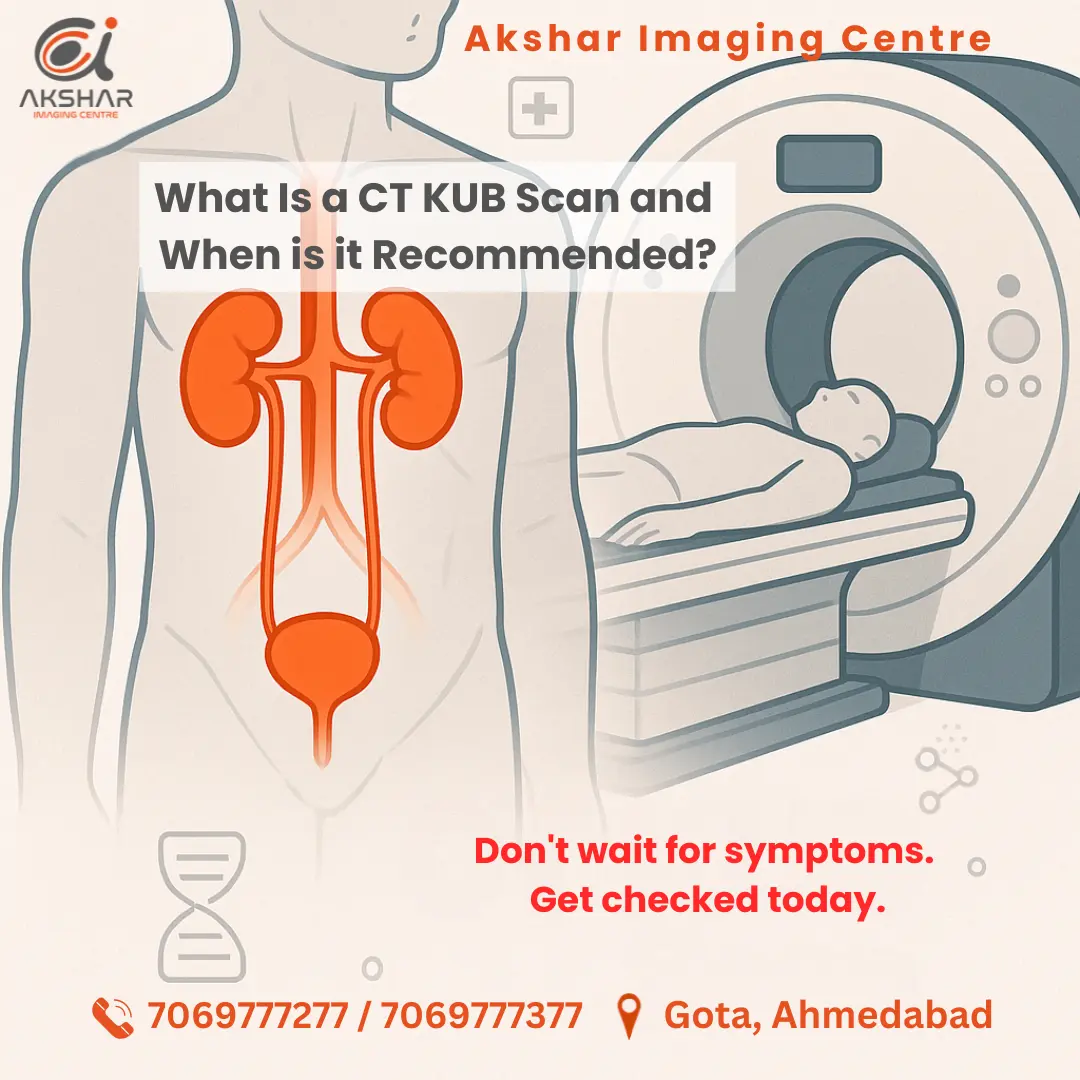 CT Scan KUB